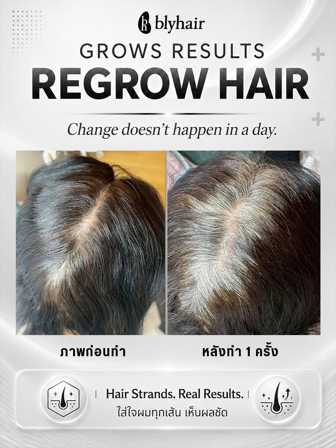 ภาพเปรียบเทียบแนวแสกผม ก่อนดูแลและหลังดูแล 1 ครั้ง