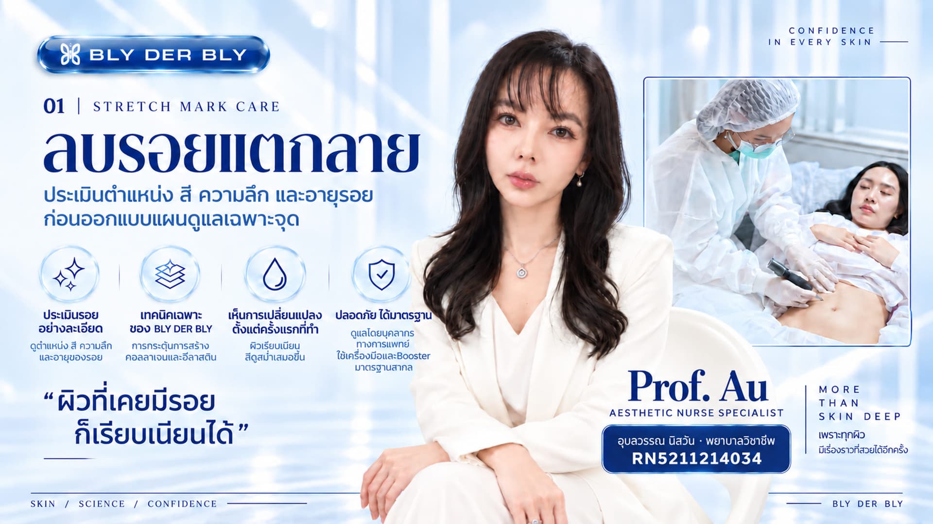 ภาพบริการลบรอยแตกลายของ BLY DER BLY