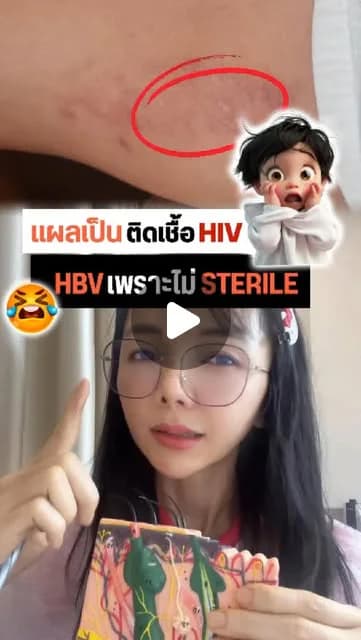 ภาพปกคลิป ผิวมีปัญหาหลังทำรอยแตกลายจากที่อื่น ควรทำอย่างไร