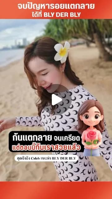 ภาพปกคลิป คุณถิงเล่าประสบการณ์ดูแลก้นแตกลาย