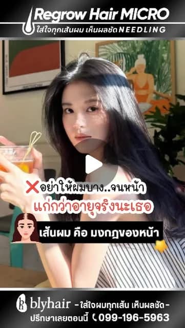 ภาพปกคลิป ผมบางและลูกผมใหม่ คุณไนน์เล่าประสบการณ์