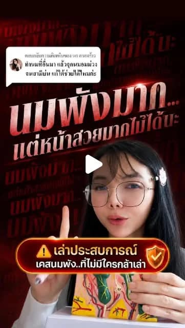 ภาพปกคลิป เคสแก้สีลานนมจากที่อื่น ต้องประเมินอะไรบ้าง
